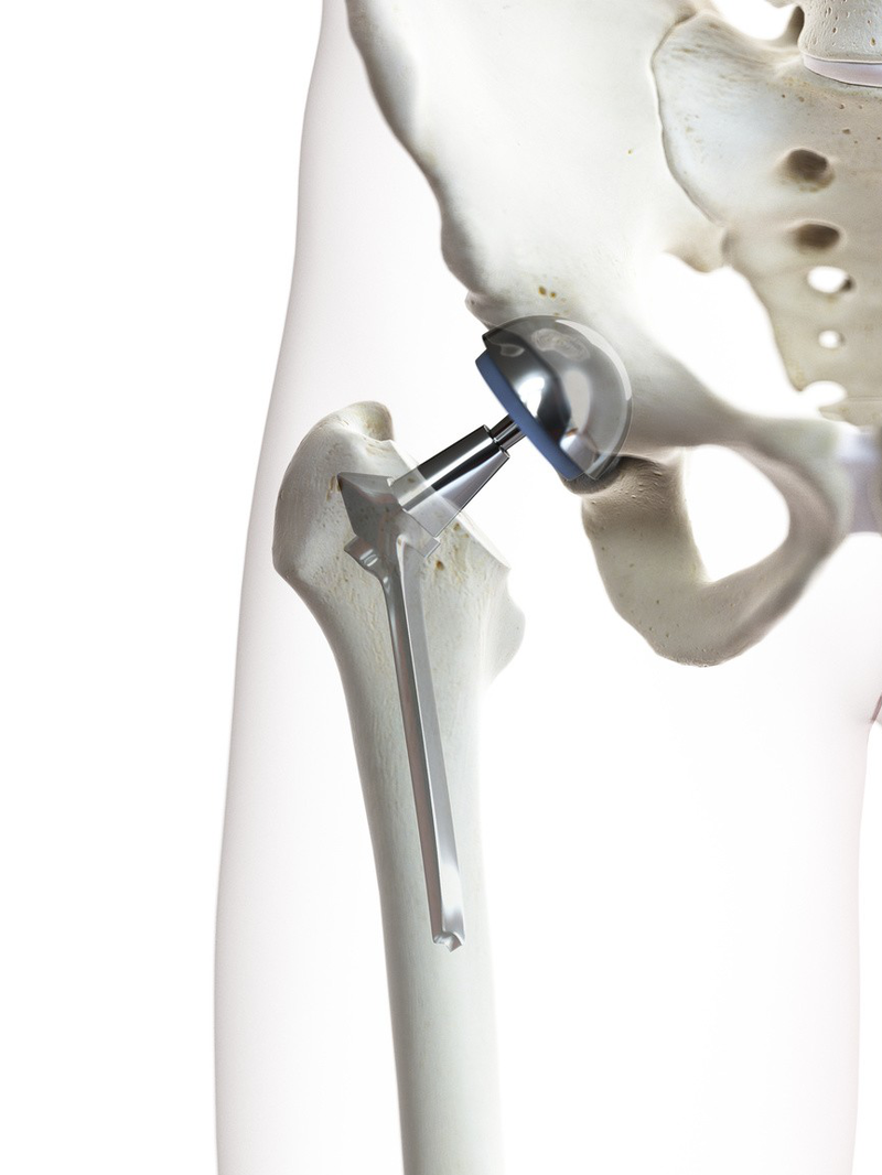 7kd40hgqmt6v1467r2vvl5i32t