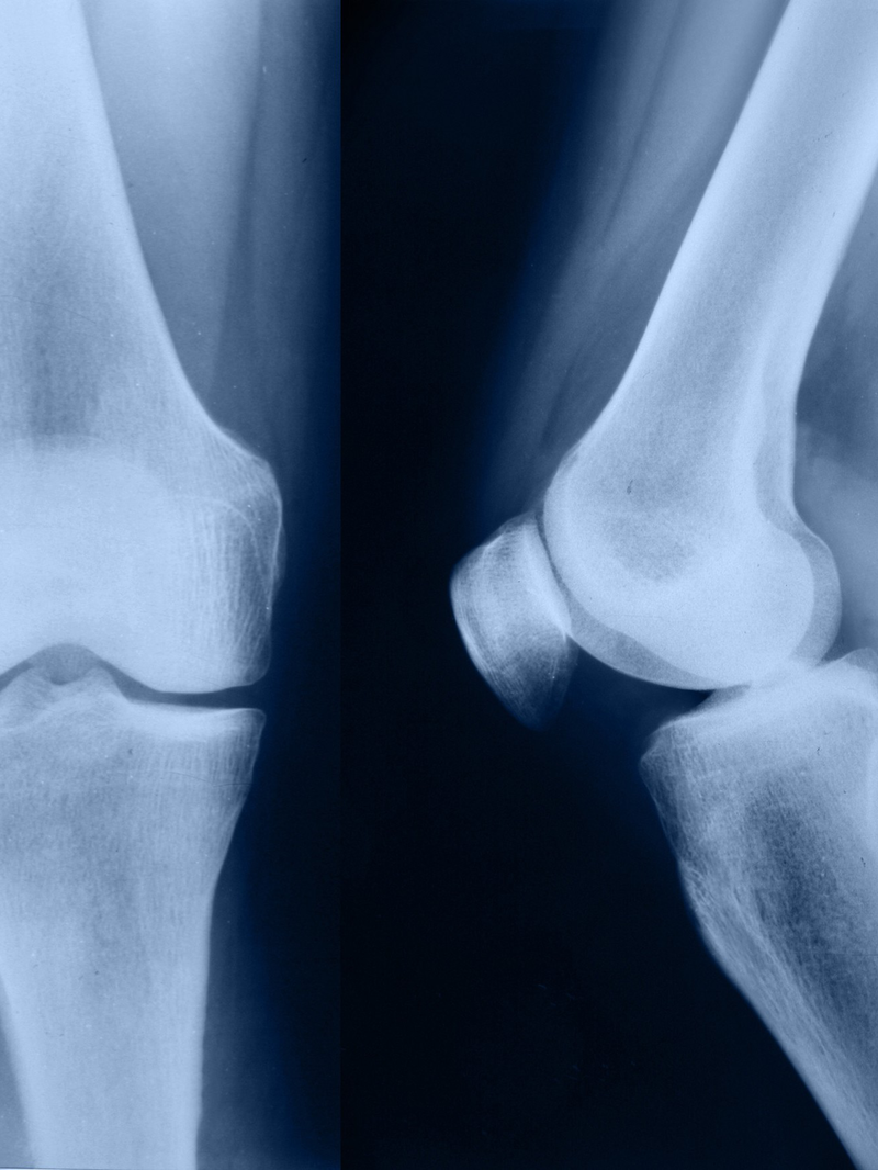 f4ss400nqp3tjd4d4sbcqq9u5s