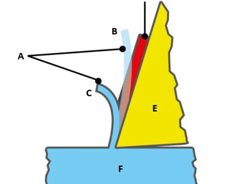 Figure 11: Basic principle of a chip-breaking geometr